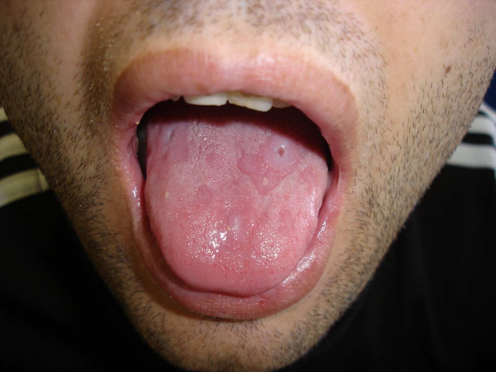 fNxLengua14NF.jpg