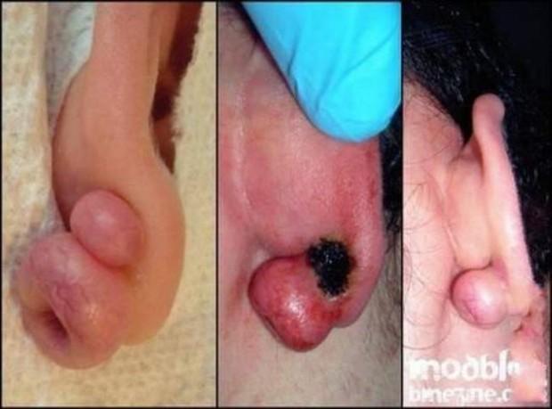Piercing może boleć 31